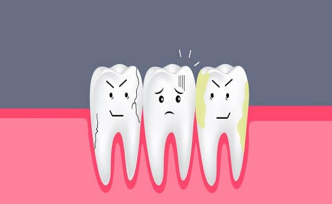 Mẹo Chữa Viêm Chân Răng - Những Phương Pháp Hiệu Quả và Đơn Giản